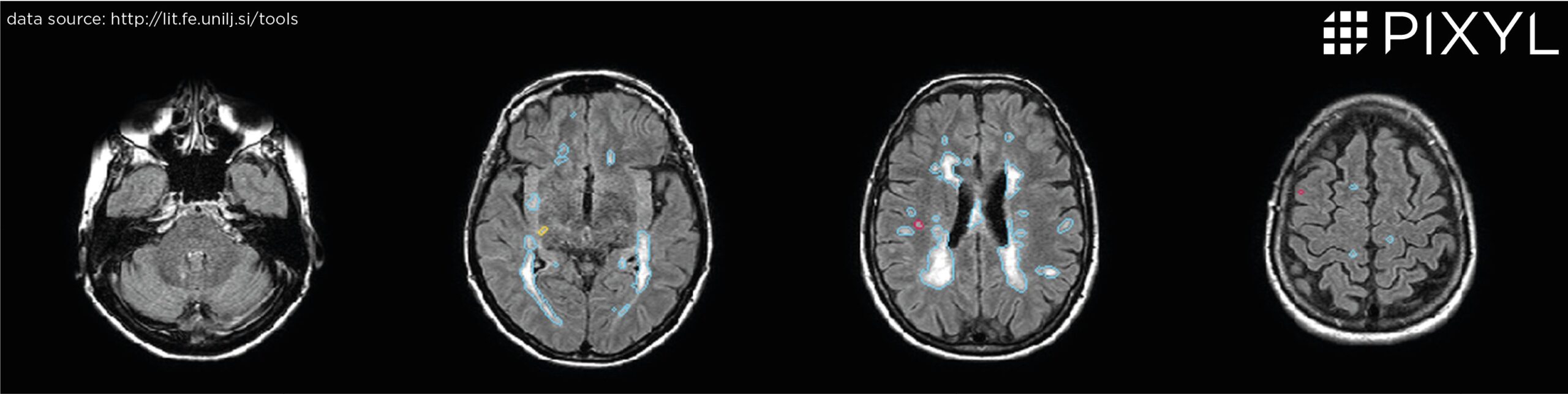 MS LUB18 screenshots(1)